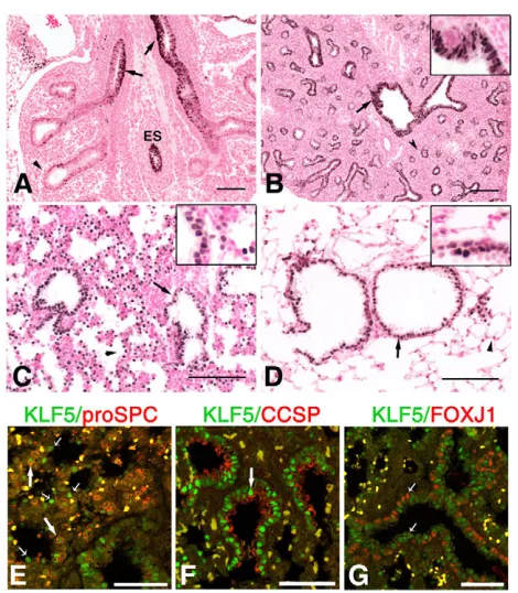 Fig. 1. Immunohistochemical analysis of KLF5 in the developing