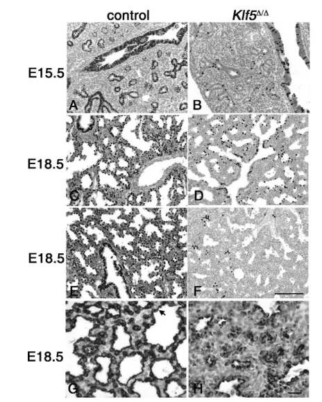 Fig. 3. Deletion of Klf5Staining was absent or decreased in  disrupts lung morphogenesis