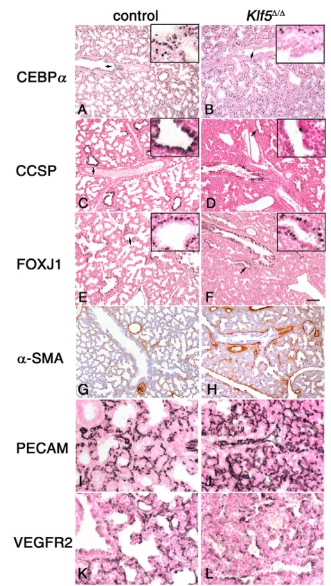 Fig. 5. KLF5 influences the differentiation of lung epithelium andmesenchyme. (A-L) Lung sections from Klf5Δ/Δ mice and littermatecontrols were prepared at E18.5 and immunostained for CEBPα (A,B),CCSP (C,D), FOXJ1 (E,F), αSMA (G,H), PECAM (I,J) and VEGFR2 