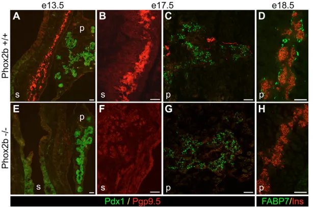 Fig. 6. Turnover of Phox2b-expressingcells.Nkx2.2 Pancreas from Nkx2.2+/+ (A,B) and–/– (C-F) mouse embryos at E12.5 (A),E13.5 (B,C), and E15.5 (D-F) were co-stainedby immunofluorescence for Pdx1 (FITC,green) and the apoptosis marker cleavedcaspase-3 (Cy3, 