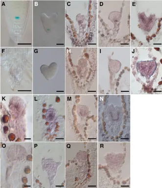 Fig. 7. Phenotypes of obe1 obe2 stmobe2 wus-1 plants. and obe1 obe2 wus mutant Fourteen-day-old seedlings of wild type (A), wus-1 (B), obe1(C), obe1 obe2 (D), stm-1 (E) and obe1 obe2 stm-1 (F).Scale bars: 2 mm.