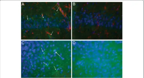 Figure 3 Increased brain inflammation (activated microglia) in 16/6-Id mice in the hippocampal regions (CA1, CA3)