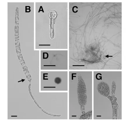 Fig. 5. Development of the immsporophyte. Scale bars: 10 �richly branched upright filaments