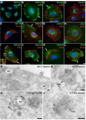 Fig. 4. Sdmg1 is localised to endosomes in Sertoli