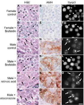 Fig. 7. Perturbing secretion induces male-to-femalegerm cell sex reversal in embryonic gonad cultures.(A-R) Urogenital ridges (11.5 dpc) were transiently treated
