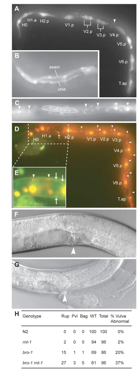 Fig. 4. BRO-1 and RNT-1 are largely co-expressed. (A-C) Animalscarrying an integrated bro-1::GFP reporter construct (dpy-20 (e2017)IV