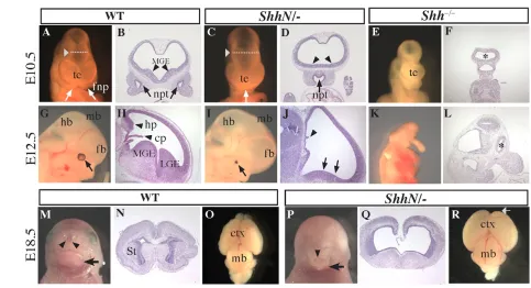 Fig. 1. Shhdefective in the N/– mutant forebrain displays HPE-like phenotypes. (A-F) Frontal view of control (A,B), ShhN/– (C,D) and Shh–/– (E,F) mouseforebrains at E10.5