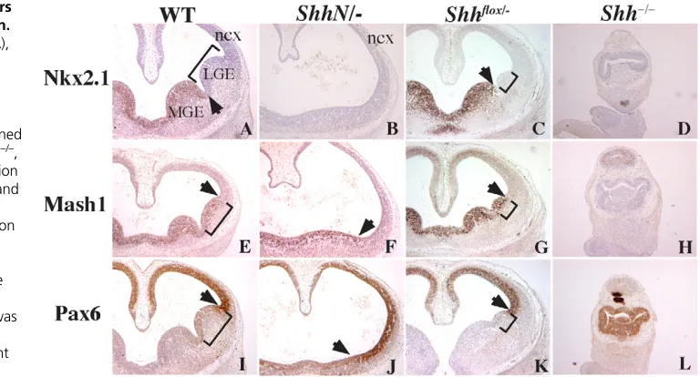 Fig. 3. Absence of MGE progenitorsN/– 