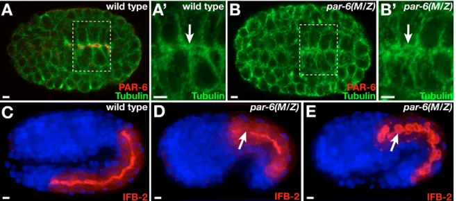 Fig. 5. Epithelial polarity in par-6(M/Z)concentrate at apical regions of intestinalepithelial cells (arrows in Astained for localization in intestinal cells of wild-type andpar-6(M/Z)continuous apical band in wild type (C)