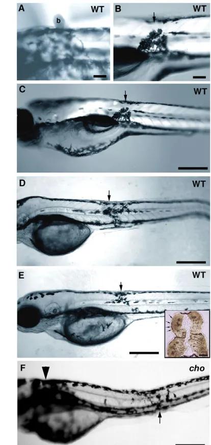 Fig. 9. Implantation of Sdf1-soaked beads into WT and chomagnification of same larva as in B