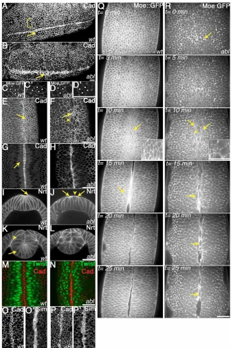 Fig. 1. Abl is required for coordinated