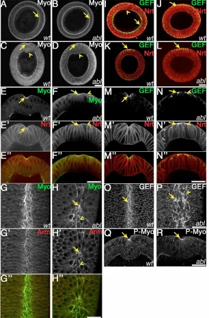 Fig. 3. Myosin and RhoGEF2 fail to uniformly