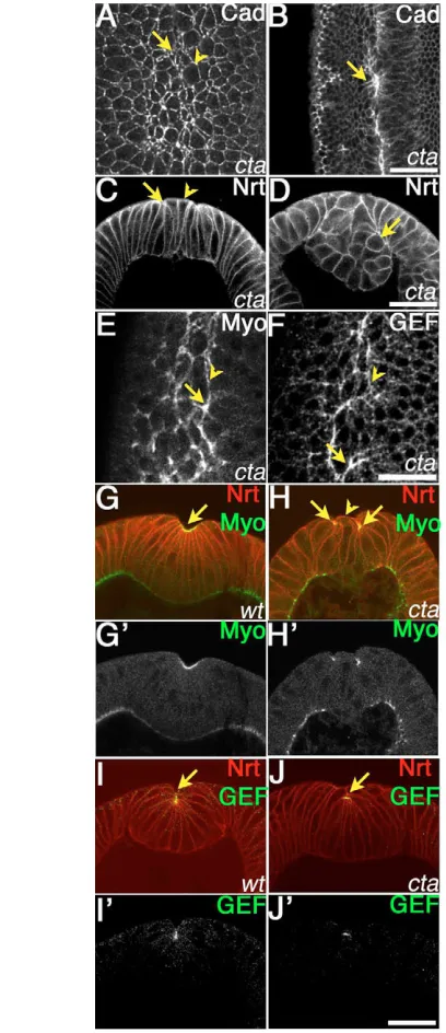 Fig. 4. cta mutants resemble abl mutants. Embryos, antigens andgenotypes are indicated