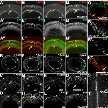 Fig. 6. Actin localization is altered