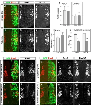 Fig. 6. Smad3 activity is both required andsufﬁcient for the generation of ventraland Lhx1/5 in control vs