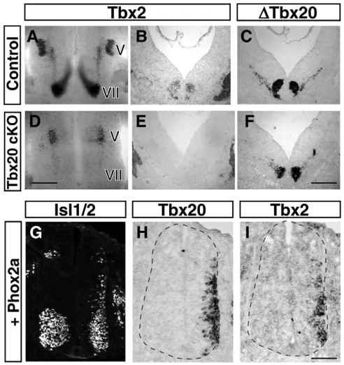 Fig. 7. A genetic interaction between Tbx20hybridization analysis on ﬂat-mounted hindbrain preparations andtransverse sections reveals that mutants