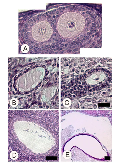 Fig. 5. Cpeband a 12-month-old mouse, respectively. Scale bars: 20 50compacted granulosa cells (compare with Fig