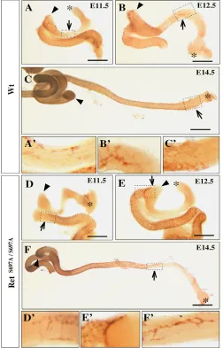 Fig. 4. Impaired migration of the ENCCs in RET S697A mutant�positive ENCCs in A-F, respectively