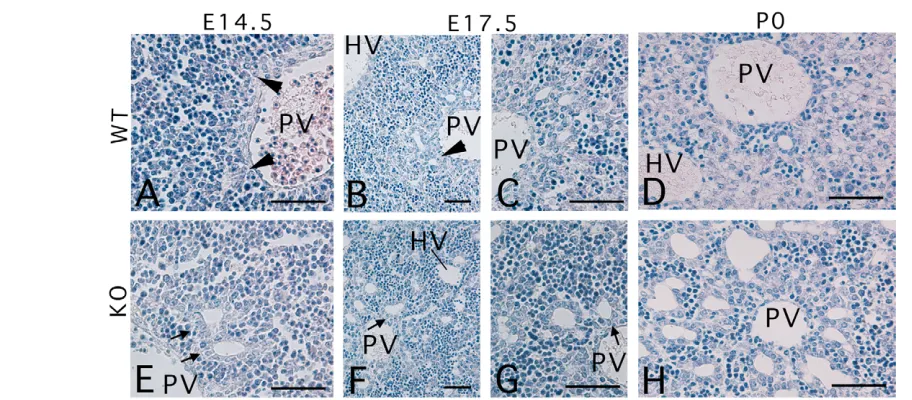 Fig. 2. Pseudoglandular development in Cebpaform pearl-like structures in 14.5-day and 17.5-day wild-type livers (arrowheads) ( knockout mouse livers