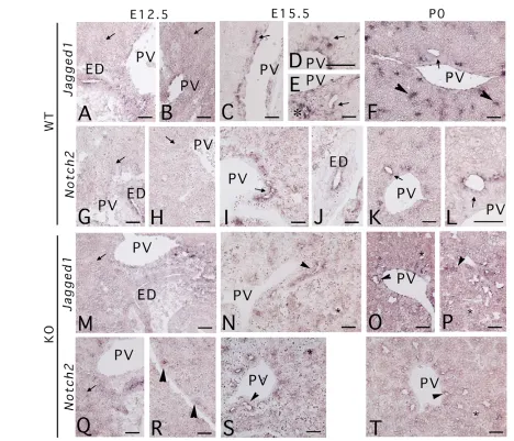 Fig. 8. In situ hybridization analysis of Jag1portal vein (N), compared with that in the 17.5-day wild-type liver (C,D,E)