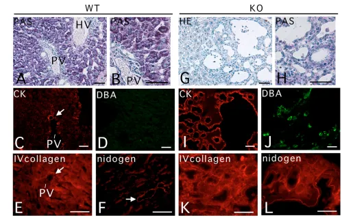 Fig. 9. Liver fragments of knockout fetuses develop cystic structures in the testes of Scidstructures strongly expressing bile duct markers in the testis (transplants (G; Hematoxylin and Eosin staining)