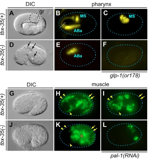 Fig. 4. Deﬁciency of MS-derived cell types in tbx-35(tm1789)