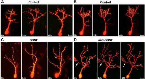 Fig. 3. Manipulations in BDNF tectal levels inﬂuence PSD95-GFP labeled postsynaptic specializations on tectal neuron dendritic arbors.anti-BDNF treatment