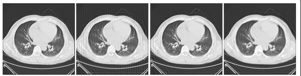 Fig. 3 Comparison of reconstructed images with different reconstruction methods (SNR = 20 dB)