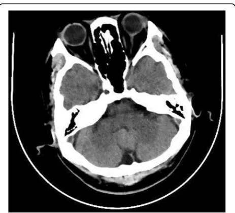 Fig. 8 Comparison of reconstructed images with different reconstruction methods (head CT)