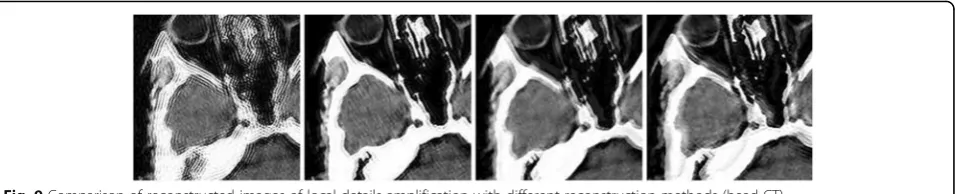 Fig. 9 Comparison of reconstructed images of local details amplification with different reconstruction methods (head CT)
