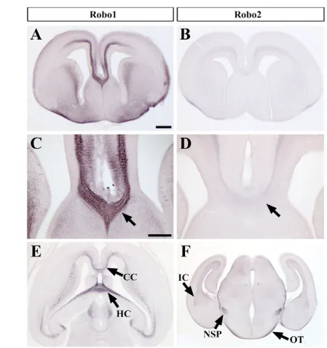 Fig. 2. Robo1 and Robo2 expression in the forebrain. Robo1 andfor A,B,E,F; in C, 100 regions, Robo1 is expressed on the hippocampal commissure (HC) andon the corpus callosum (CC) (E, horizontal view at E17); Robo2 isexpressed on the nigrostriatal pathway (