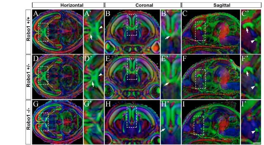 Fig. 3. Magnetic resonance diffusion tensor imaging of Robo1 knockout brains. To survey the entire brain for axonal tract defects, wechanged from mediolaterally (green) to dorsoventrally (blue) projecting