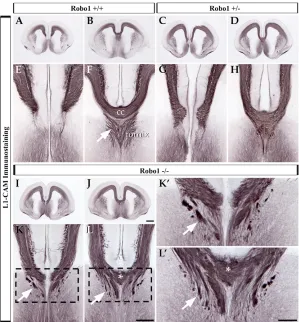 Fig. 5. Tract tracing analysis reveals majorpathﬁnding defects in callosal andhippocampal axons
