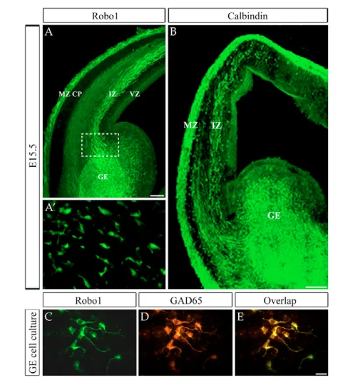 Fig. 8. Robo1, calbindin and GAD65 immunohistochemistry ofcells from the ganglionic eminence.chieﬂy in the GE, and in the corridors within the cortex used bymigrating cortical interneurons, the MZ and lower IZ