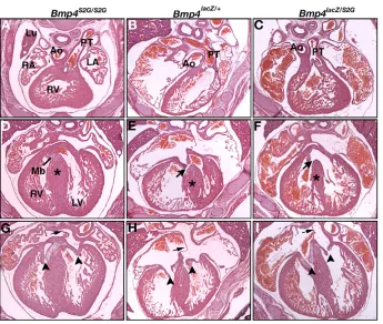 Fig. 7. Ventricular septal defects inlacZ/+ lacZ/S2G 