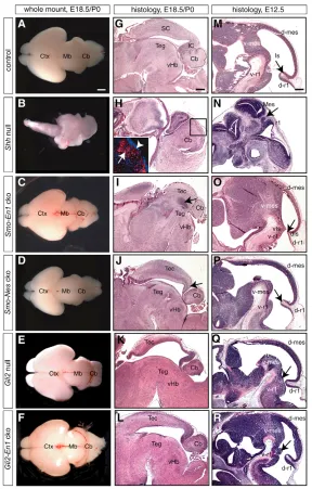 Fig. 1. Mid/hindbrain phenotype in the absence oftotal or Gli2A-mediated Shh signaling