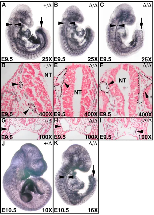 Fig. 5. The vascular architecture of Tak1In all panels, the developing vasculature of embryos was visualized bywhole mount immunohistochemistry using an (�/� embryos is abnormal.�-PECAM antibody.A) Tak1+/� at E9.5