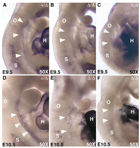 Fig. 6. Tak1�/� embryos have defects in vascular smooth muscle.To visualize smooth muscle, embryos were stained byimmunohistochemistry using an antibody to SMA (purple staining in allpanels)