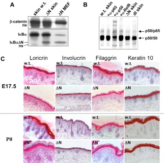Fig. 1. Reduced NF-�B activity in skin ofIBN 