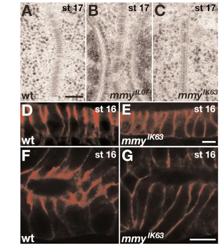 Fig. 3. Septate junctions (SJs) are defective in mmymmyoccasionally mislocalised in seen as ladder-like structures
