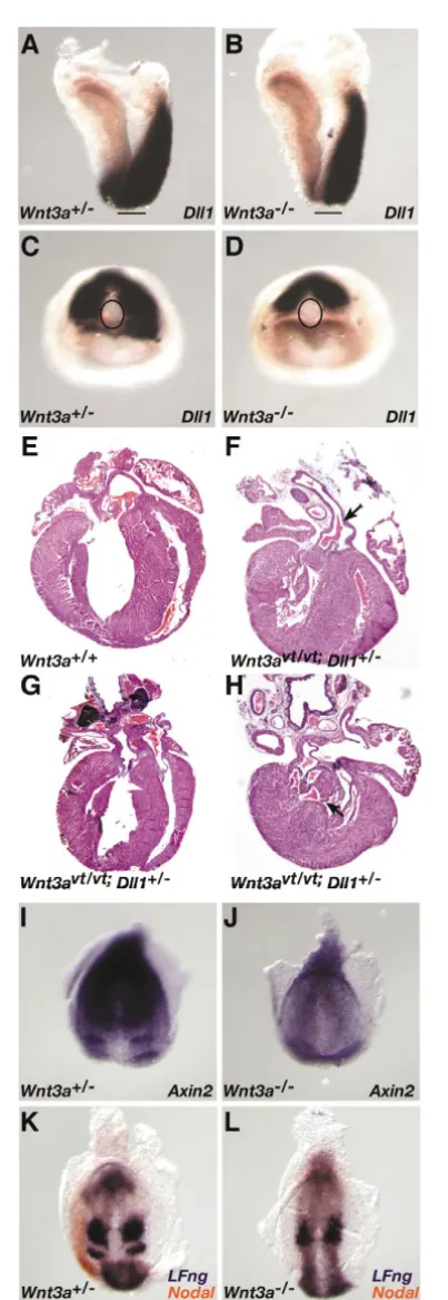 Fig. 6. Components of the Notch pathway participate in a Wnt3a-(presomite 0) in wild-type one-somite embryos (I), was down-regulated in mutants, including PTA (arrow, F), TGA (G) and VSD (arrow, H).(I,J) expression (orange) in the wild-type left LPM