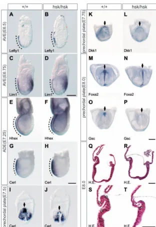 Fig. 4. Expression of anterior patterning markers in hybridization showing gene expression in the anterior visceral endoderm (AVE)(A-D), anterior deﬁnitive endoderm (ADE) (E-H) and the prechordal plate (I-P) inwild-type and Ssdp1hsk/hsk mutants