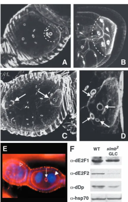 Fig. 3. Germ cell mitosis is misregulated in Ring canals are visualized by TRITC-Phalloidin staining