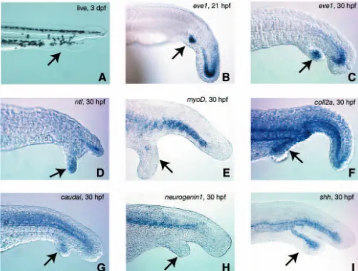 Fig. 5. Analysis of gene expression in the ectopic tails. Embryossonic hedgehogwere heatshocked from shield to bud stage to maximize ectopic tailformation, then photographed live at 3 dpf (A), or ﬁxed at either 21hpf (B) or 30 hpf (C-I)