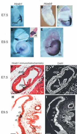Fig. 1. Expression of Hoxb1 and Hoxb9 during mouse embryogenesis.(A-C) Whole-mount in situ hybridisation to detect Hoxb1 (A) orHoxb9 (B,C) expression in E7.5 embryos