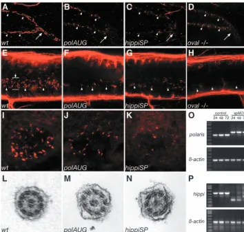 Fig. 2. Cilia structure is altered in IFT morphant embryos. A whole-mount confocalimmunostaining of acetylated tubulin in 44 hpf embryos shows apical cilia in the pronephric ducts(A-D), the spinal canal (E-H) and Kupffer’s vesicle (I-K)