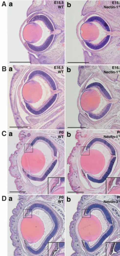 Fig. 4. Developmental analysis of the eyes of nectin 1(C,D) mice. (A-D, part a) Wild-type embryos