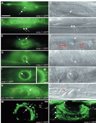 Fig. 3. SMP-1 expressed on the lumen-facing sideµof vulva rings guides vulva cell migration.B,D,F,H,J,L are DIC microscopic images ofA,C,E,G,I,K, respectively