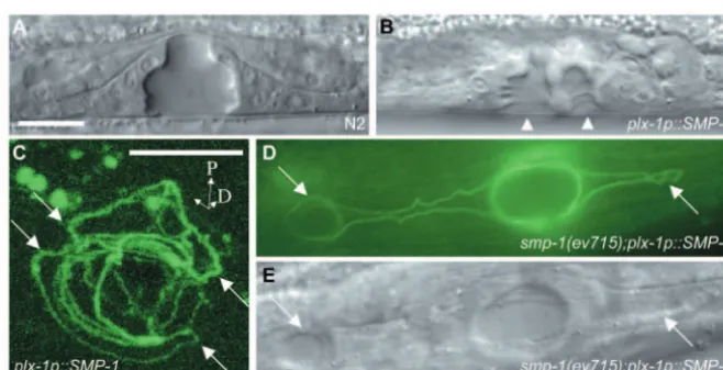 Fig. 4. Vulva cell migration defects are causedby ectopic expression of . Observations
