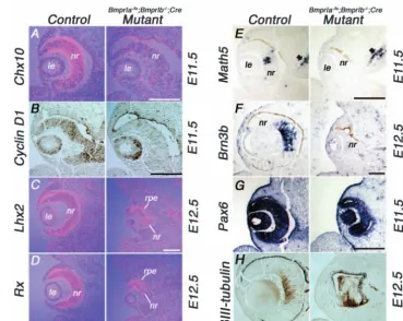 Fig. 5. Defects in retinal growth in C; 100 Bmpr1a–/fx;Bmpr1b–/–;Cre double mutant mice